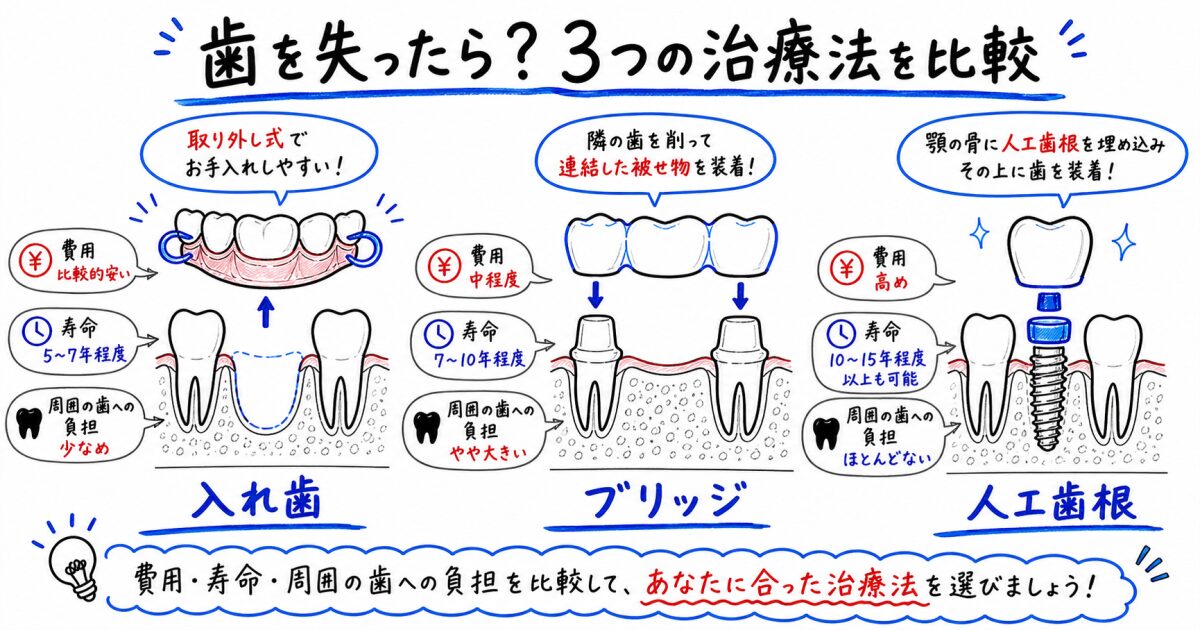 歯を失ったら?入れ歯・ブリッジ・インプラントの将来リスクと費用を比較