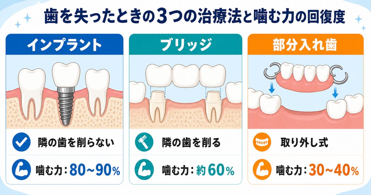 歯を1本失ったらどうする?3つの治療法の基本特徴と「噛む力」の回復度