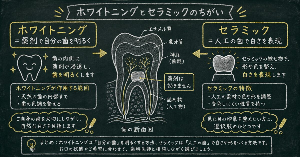 セラミック治療とホワイトニングの根本的な仕組みと違い