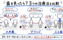 歯を失ったら？入れ歯・ブリッジ・インプラントの将来リスクと費用を比較