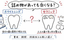 詰め物があっても白くなる？セラミックとホワイトニングの違いと選び方