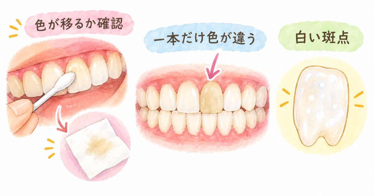 ティッシュや歯間ブラシで着色と内部変色を見分ける具体的なテスト方法