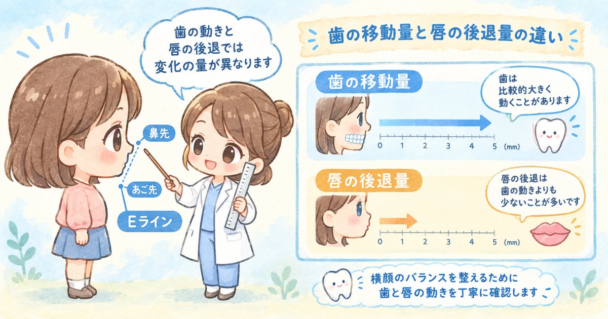 抜歯矯正で口元はどこまで下がるのか、変化量の考え方